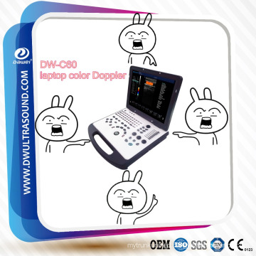 Durable portable ultrasound for human use, laptop color Doppler
Welcome your enquiry!